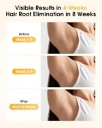 LYSMOSKI IPL Laser Hair Removal Device – Pain-Free At-Home Hair Removal for Women & Men, Long-Lasting Results for Face, Armpits & Bikini Area - Image 3