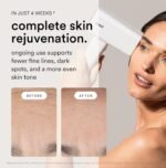 Flasher Pro IPL Hair Removal & Red Light Therapy Device – Pain-Free Permanent Hair Removal for Women and Men – Gloss White - Image 5